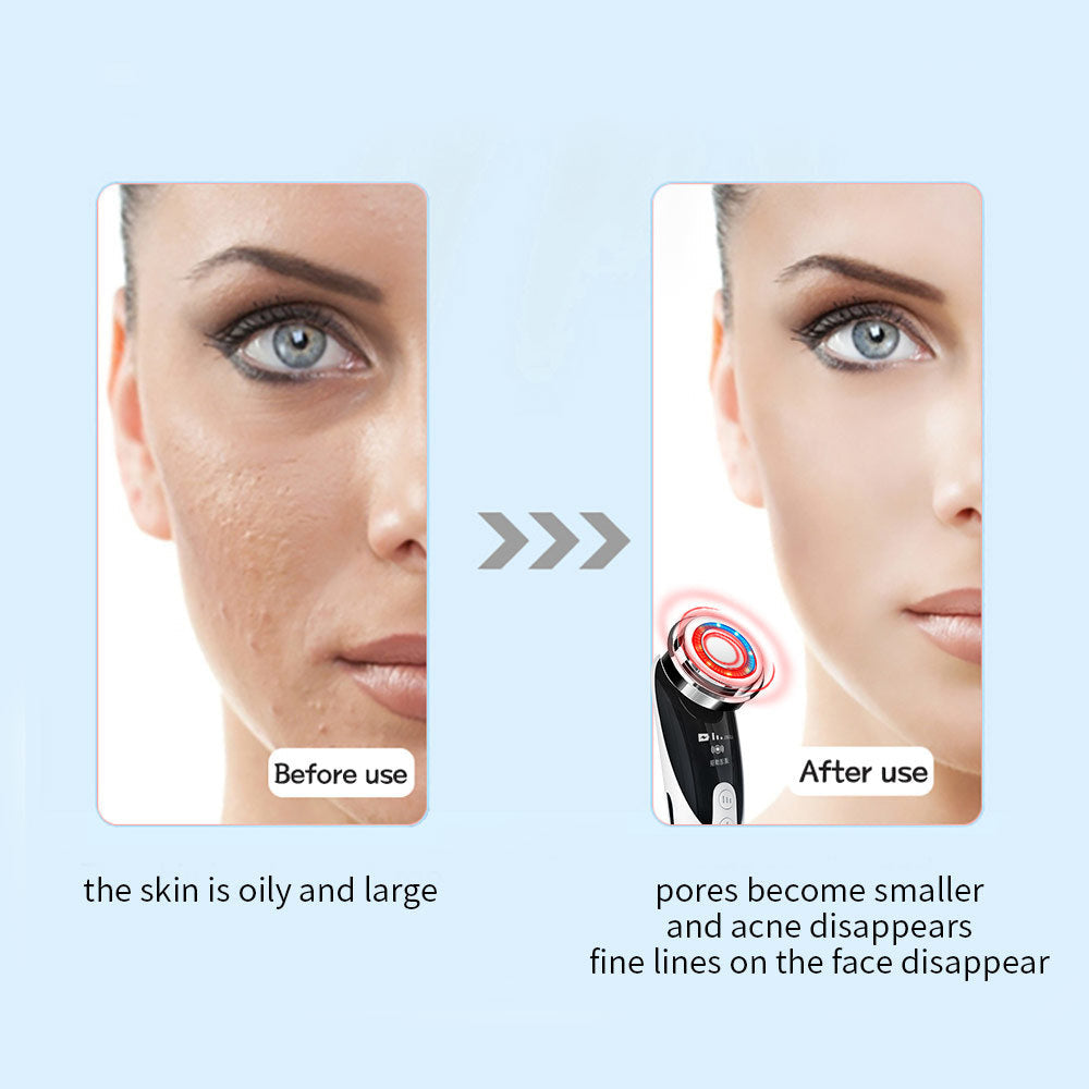 Face Massager Skin Rejuvenation Radio Mesotherapy LED Facial Lifting
